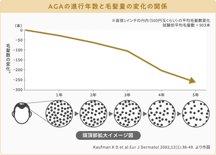 AGAの進行年数と毛髪量の変化の関係