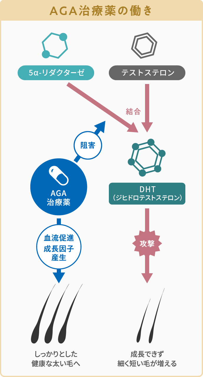 医師監修】AGA治療は一生続けるの? やめるとどうなる?