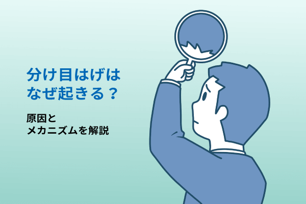 分け目はげはなぜ起きる？原因とメカニズムを解説